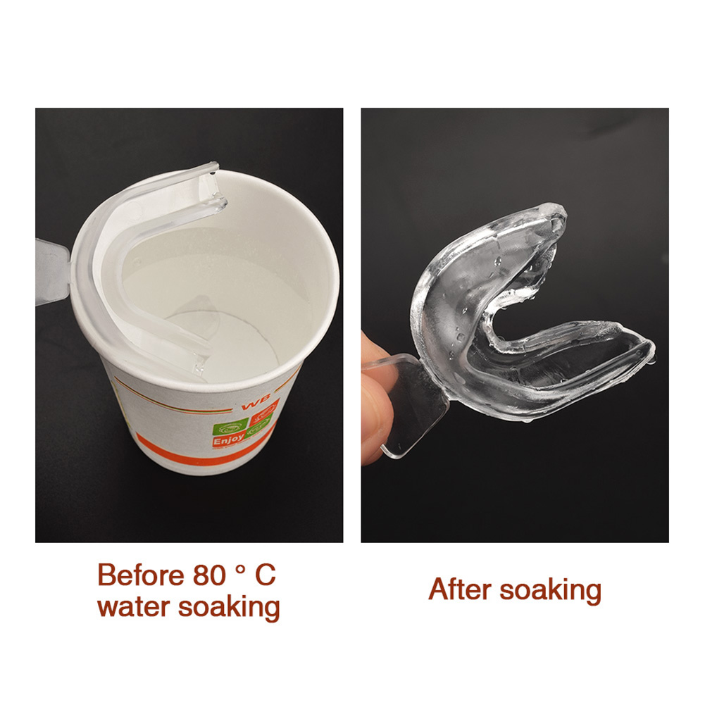 2-10pcs Silicone Mouth Guard O - Teeth Whitening For Trays ulasan dan harga