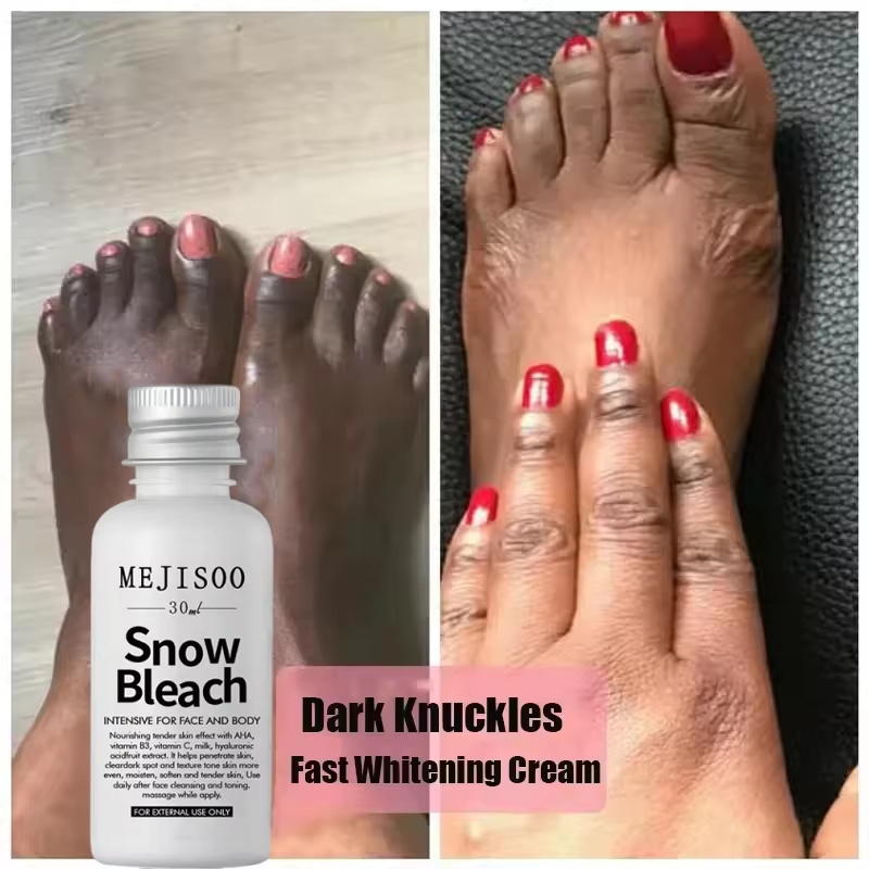 Fast Whitening Dark Knuckles B - Charcoal Whitening Paste ulasan dan harga