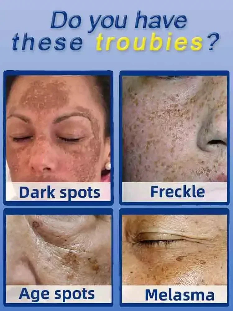 Dark Spot Remover for Face Rem - Charcoal Whitening Paste ulasan dan harga