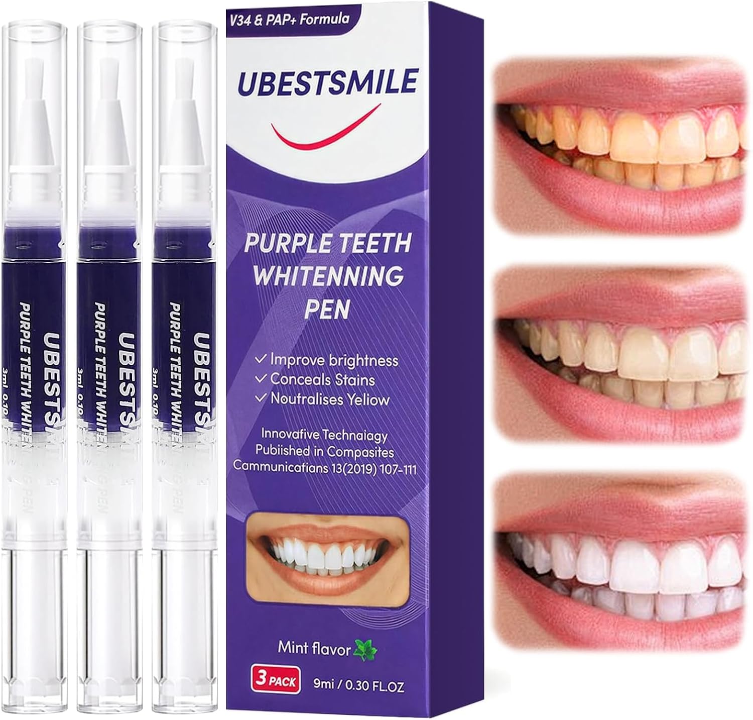 UBESTSMILE V34&PAP+ Formula Pu - Teeth Whitening Pen ulasan dan harga