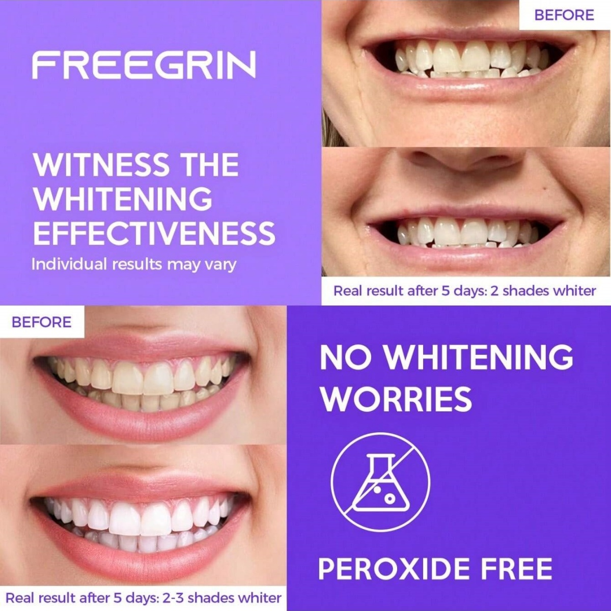 Deluxe Whitening Teeth Sticker - Teeth Whitening Q&M ulasan dan harga