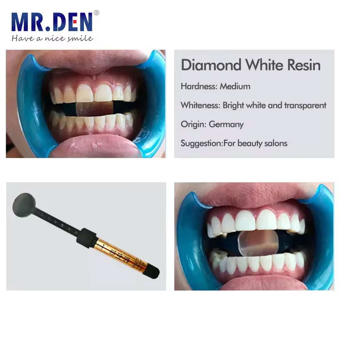 Nano Enamel Veneer Material Te - Teeth Whitening Veneers ulasan dan harga