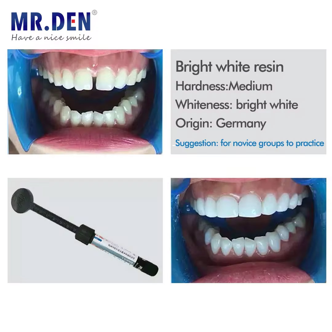 Nano Enamel Veneer Material Te - Teeth Whitening Veneers ulasan dan harga