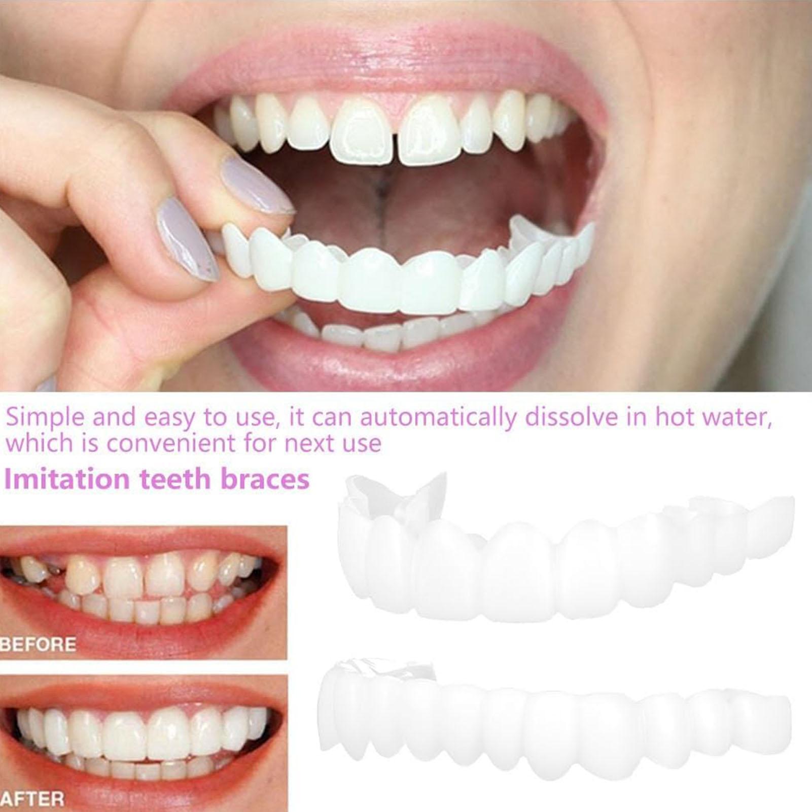 2pcs Men Women Temporary Teeth - Teeth Whitening Veneers ulasan dan harga