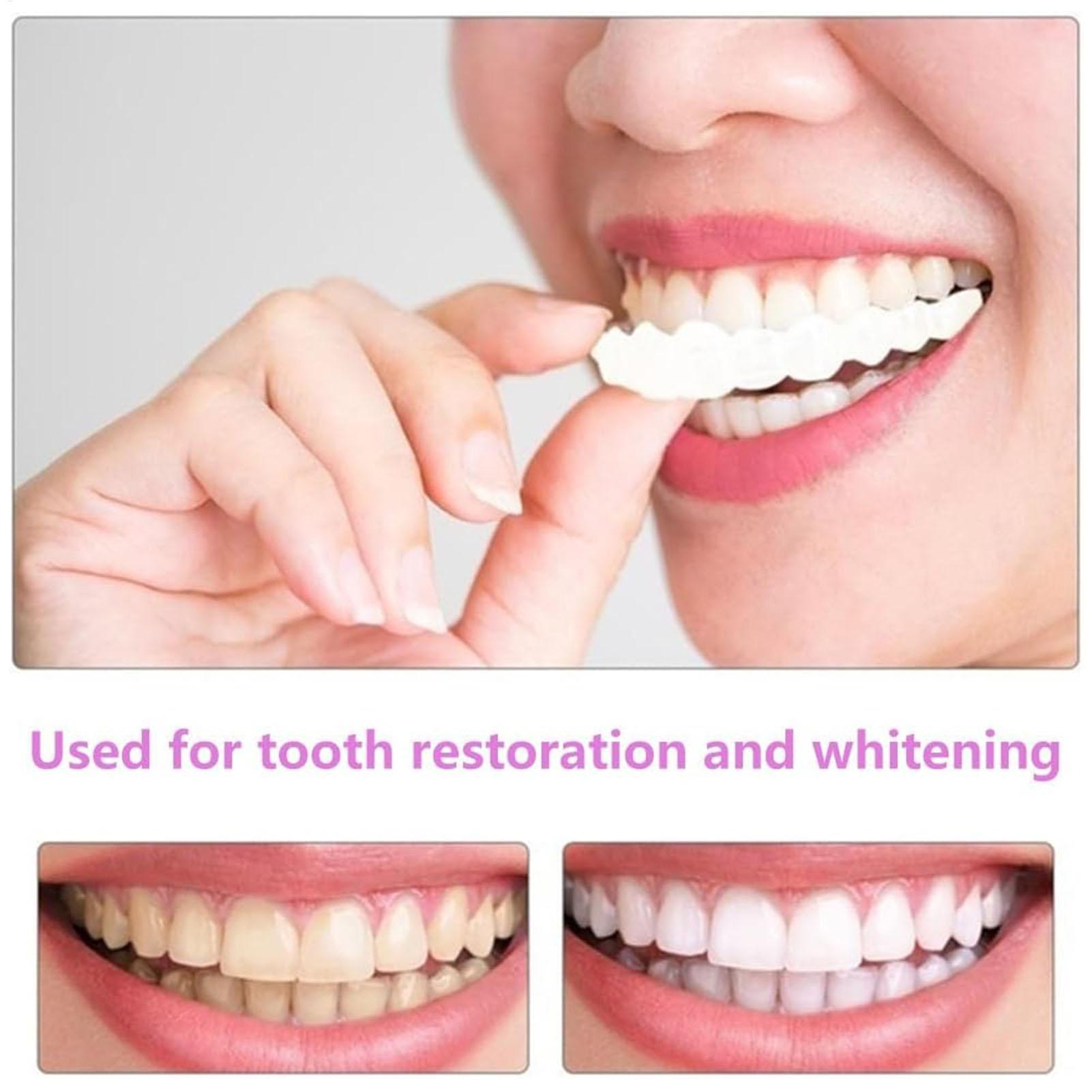 2pcs Men Women Temporary Teeth - Teeth Whitening Veneers ulasan dan harga